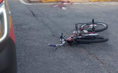 Jovem pilotando bicicleta fica gravemente ferido na Prainha